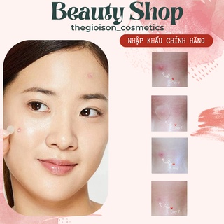Miếng dán mụn ACNE Pimple Master Patch Cosrx 24 miếng