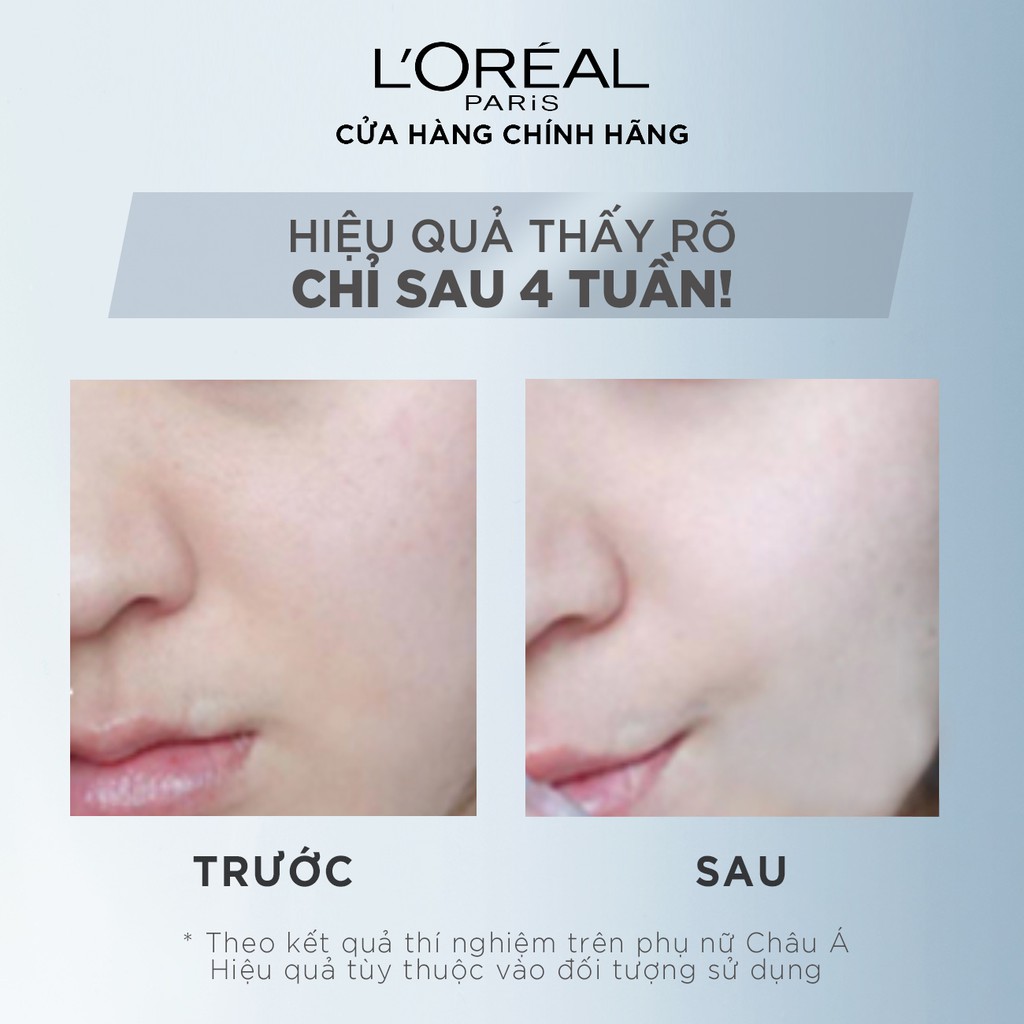 Tinh chất dưỡng trắng da, giảm thâm nám L'Oreal Paris Aura Perfect Clinical 30ml | BigBuy360 - bigbuy360.vn