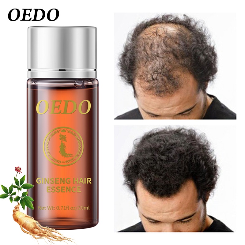 Set 2 serum tinh chất nhân sâm OEDO kích thích tóc mọc dày phục hồi chân tóc mạnh mẽ nhanh chóng