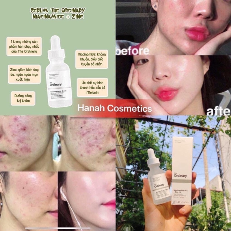 TINH CHẤT THE ORDINARY NIACINAMIDE 10% + ZINC 1% 30ML