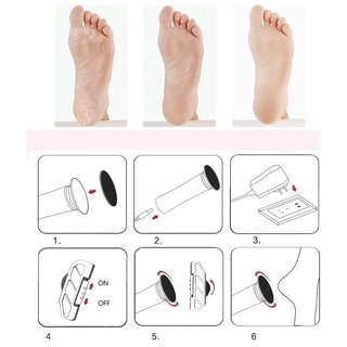 Máy Chà Gót Chân - Tẩy Tế Bào Chết