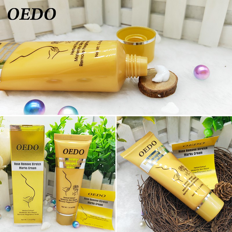 OEDO Rose Remove Stretch Marks Cream 40g | BigBuy360 - bigbuy360.vn
