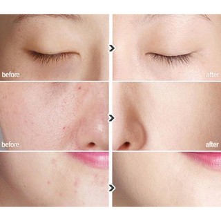 KEM NỀN DIORSKIN FOREVER UNDERCOVER (hàng tester )