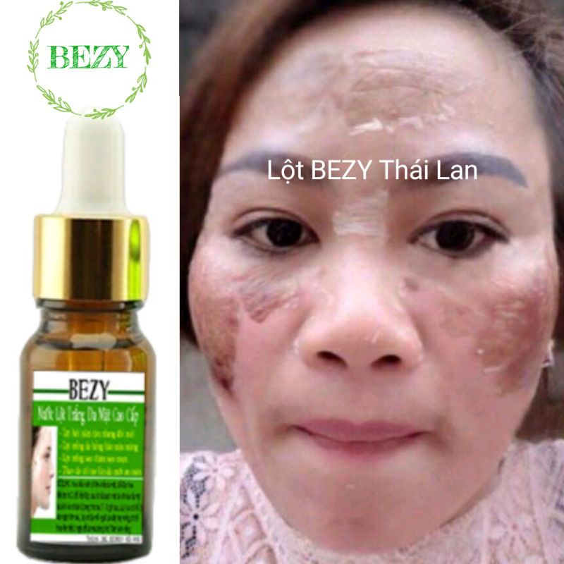 Lột Bong Da Mặt Trắng Da Nam Nữ Bezy
