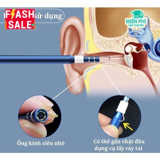 Camera nội soi lấy ráy tai