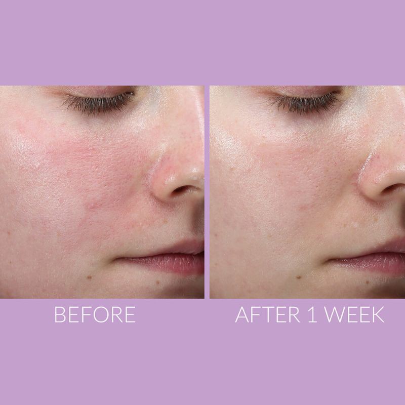 [Minisize 10ml ] Serum dưỡng da Kate Somerville DeliKate Recovery