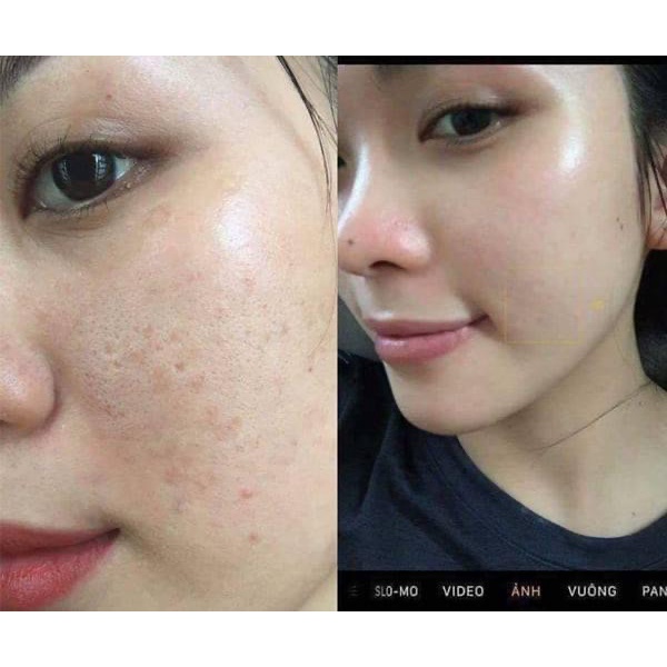 Kem Face Collagen Sữa Non Thâm Nám Trắng Da Femmiu 30 gr Chính Hãng Tặng Mặt Nạ