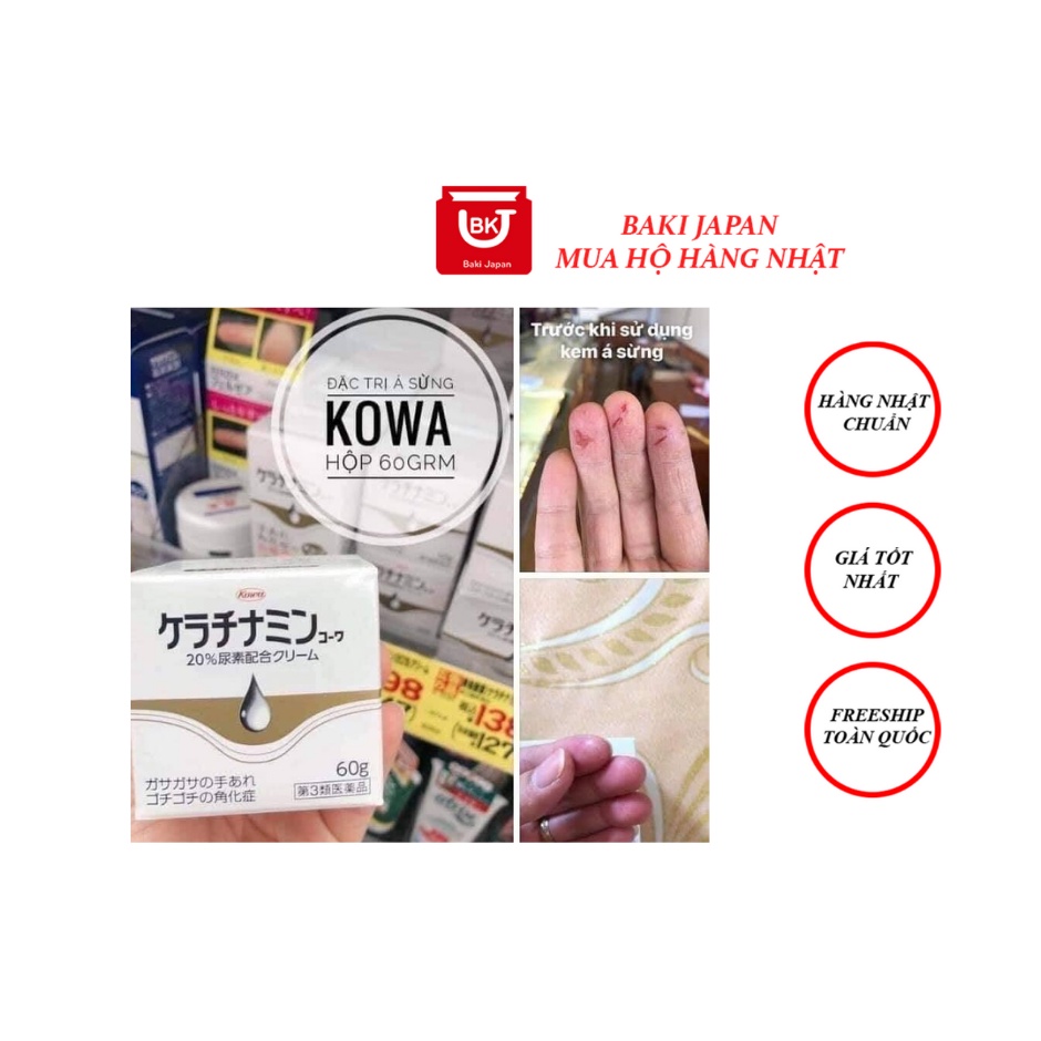 Kem bôi á sừng Kowa, Viêm da cơ địa, giảm nứt nẻ, khô ráp Nhật Bản