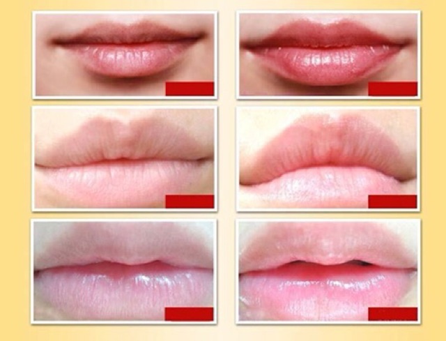 SON DƯỠNG BLISTEX LIP MEDEX CHÍNH HÃNG