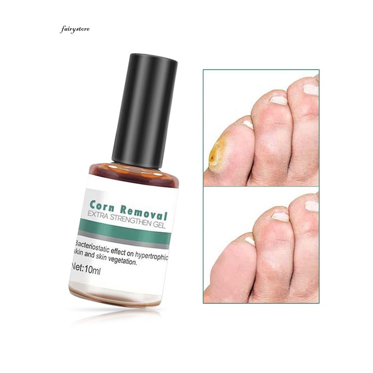 Kdfs- Tinh Chất Loại Bỏ Các Vết Đốm Và Loại Bỏ Lõm Mini Sử Dụng Ngoài Sử Dụng Ngoài