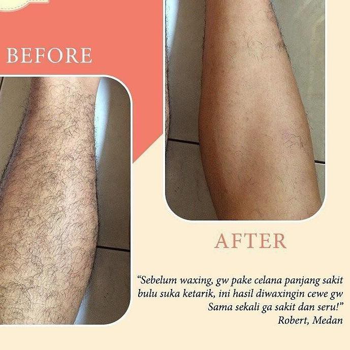 (Hàng Mới Về) Bộ Dụng Cụ Tẩy Lông Mirael Tiện Dụng | BigBuy360 - bigbuy360.vn