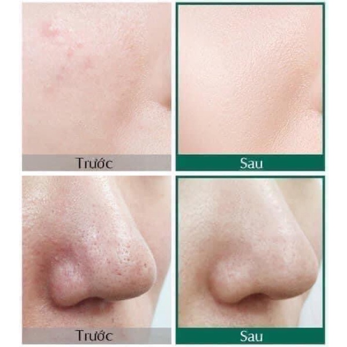 Combo lựa chọn