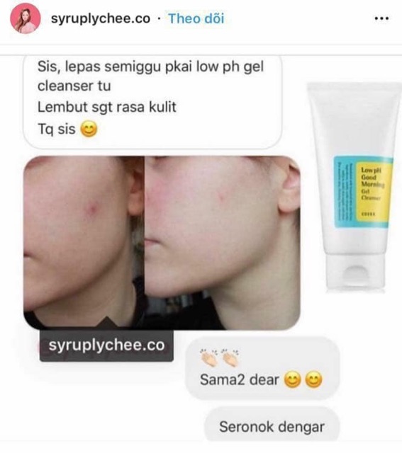 Sữa rửa mặt COSRX LOW PH GOOD MORNING GEL CLEANSER