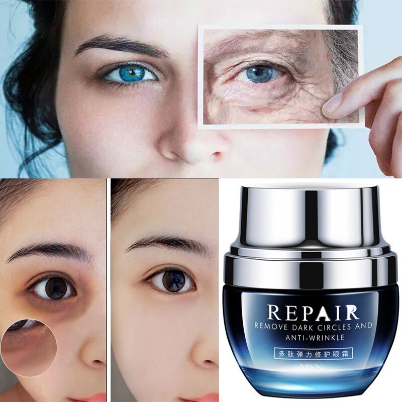 Kem xóa quầng thâm mắt kem loại bỏ nếp nhăn vùng mắt serum mắt 38g tạm biệt quầng thâm và bọng mắt