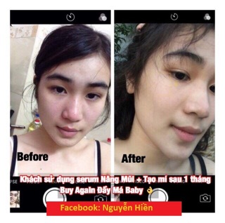 Serum Nâng Mũi Hàn