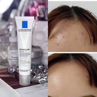 La Roche-Posay Duo+ - Kem Giảm Mụn Thần Thánh 40ml