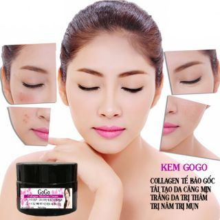 Kem Tế Bào Gốc GoGo Trắng Da Sạch Mụn