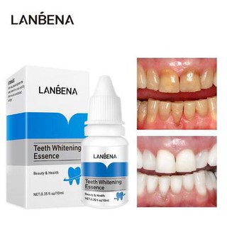 Huyết thanh làm trắng răng Lanbena