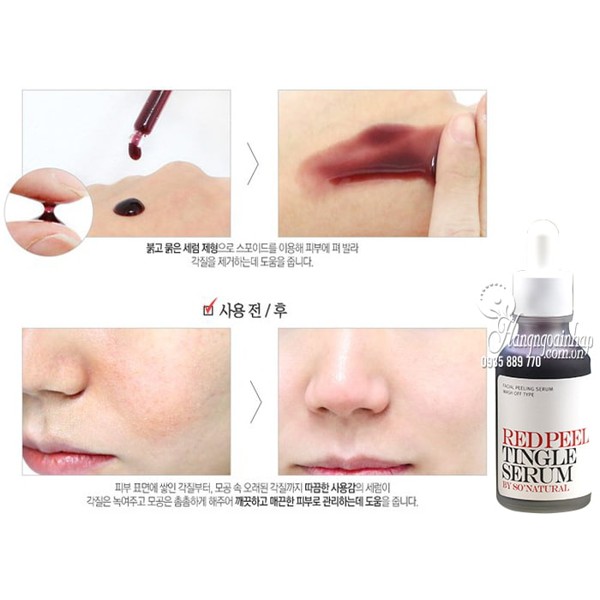 Red Peel - Serum Tái Tạo Phục Hồi Da Sinh Học