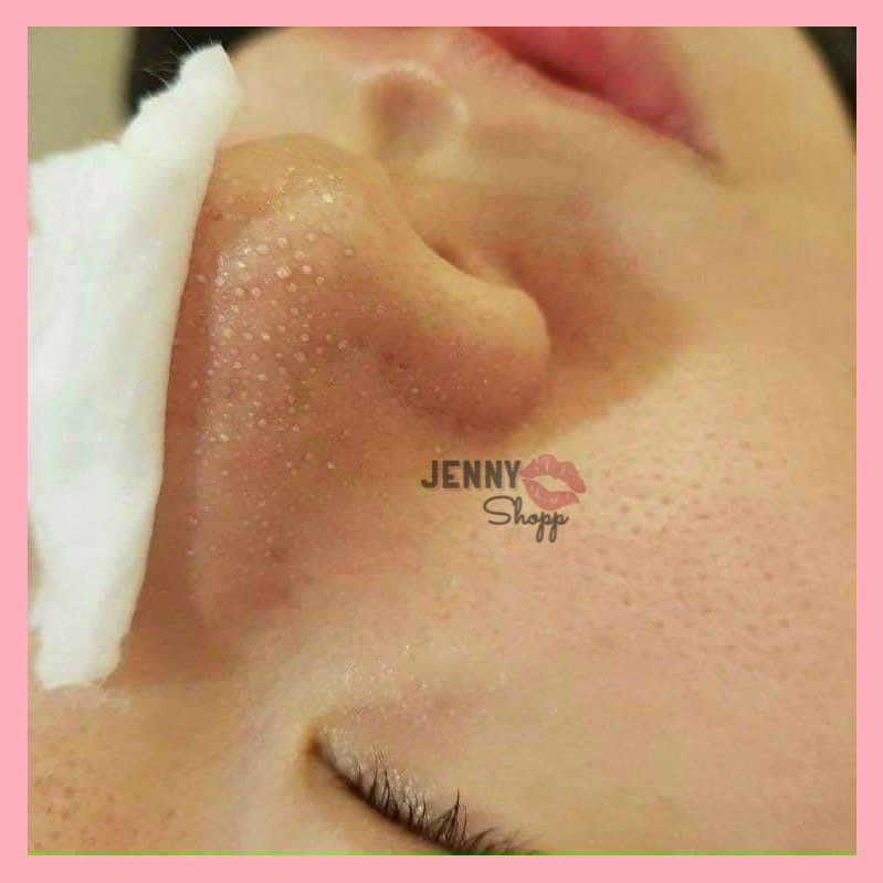 Dung Dịch Ủ Mụn MediPeel Super Extra 9 Plus | BigBuy360 - bigbuy360.vn