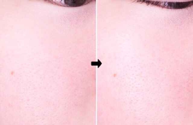 Serum Trà Xanh Innisfree Green Tea Seed Serum 15ml