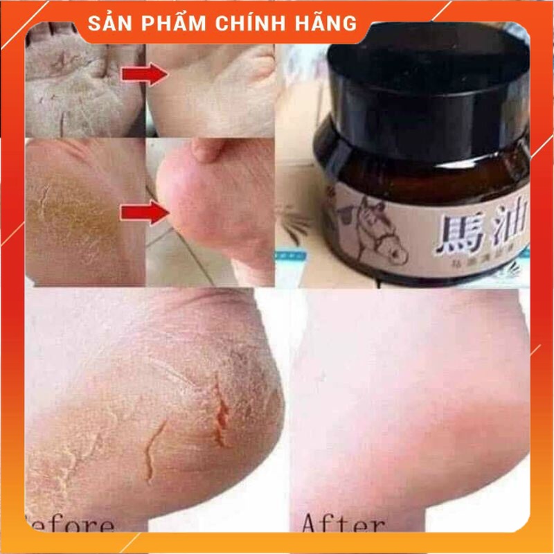 Kem Dầu Ngựa Chống Nứt Gót Chân, Nẻ Da Tay Hàng Chất Lượng 30gr - phukientrungbinh