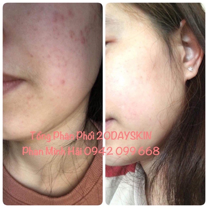 20dayskin ( vitamin tốt nhất cho da) | Thế Giới Skin Care