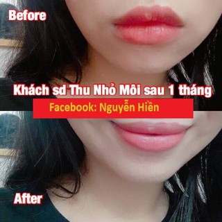 Tinh Chất Thon Gọn Môi Miracle