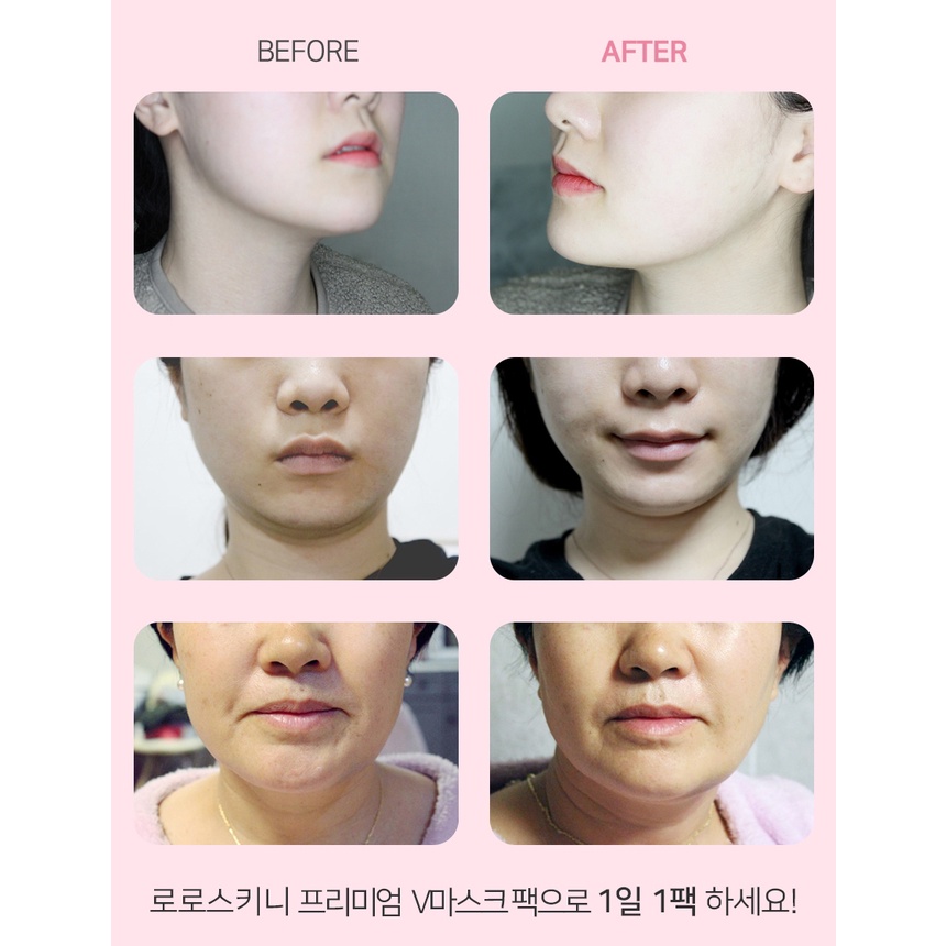 Set 5/ 10 mặt nạ nâng cơ mặt hydrogel tạo kiểu cằm chữ V dành cho làm đẹp