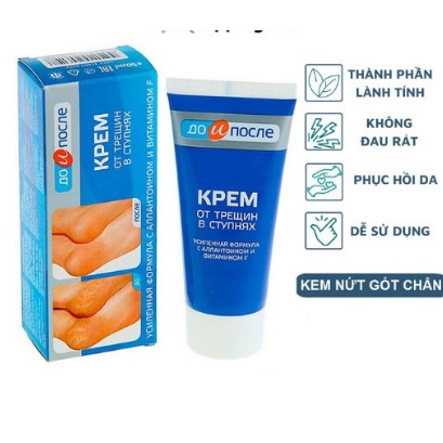 Kem nứt gót chân Nga Kpem,dưỡng da chân,Ngăn Ngừa Và Hồi Phục Nứt Nẻ Gót Chân 50ml