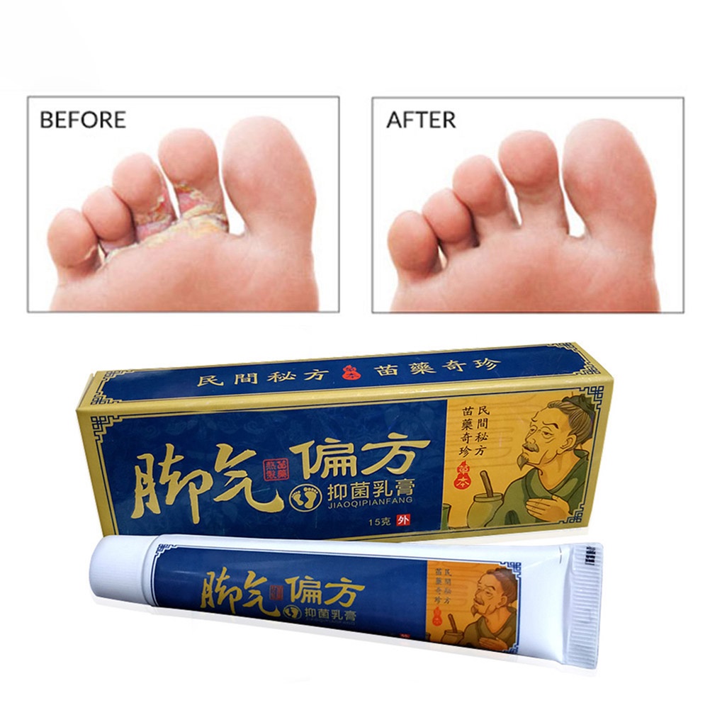 Kem giảm nấm và chăm sóc da chân hiệu quả