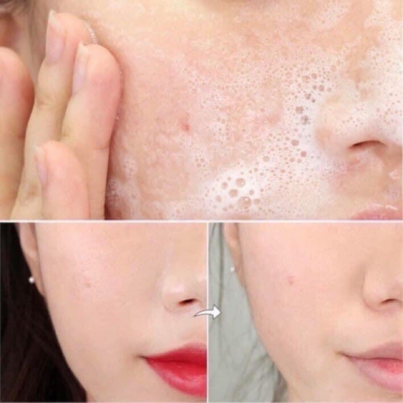 {CÓ BILL} Sửa rửa mặt COSRX LOW PH GOOD MORNING GEL CLEANSE chính hãng | BigBuy360 - bigbuy360.vn