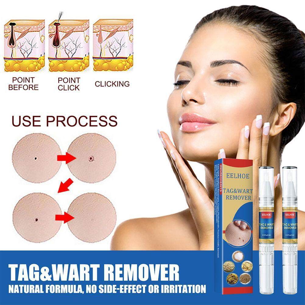 Skin Thẻ Bút Xóa Nốt Ruồi, Thẻ Da An Toàn Di Động, Nốt Ruồi Remover