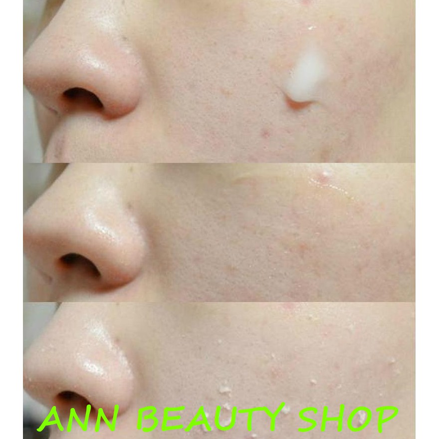 Gel tẩy da chết Missha Super Aqua 10 Hyaluronic Acid Ultra Hyalron Peeling Gel 100ml (bản 2020) | BigBuy360 - bigbuy360.vn