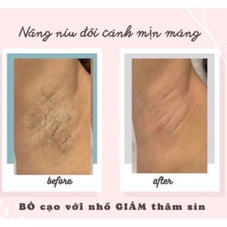 Combo triệt lông không nồi ( sáp + mỡ Trăn )