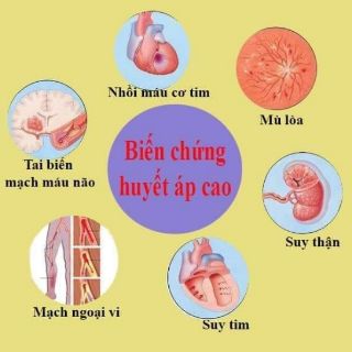 Máy đo huyết áp Glucerna