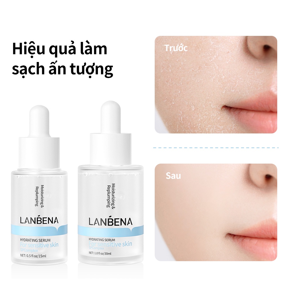 Serum Lanbena Dưỡng Ẩm Làm Sáng Da Chống Nếp Nhăn 4D 30ml