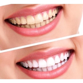 Kem đánh răng Crest 3D Advanced Tripple whitening 158g