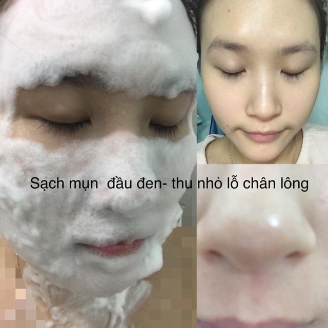 [Sale] Combo thải độc và tắm trắng detox blanc