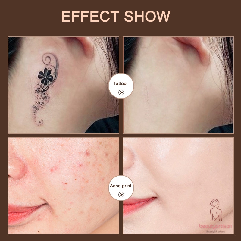 [Hàng mới về] Kem che vết xăm/sẹo 2 tông màu chống nước | BigBuy360 - bigbuy360.vn