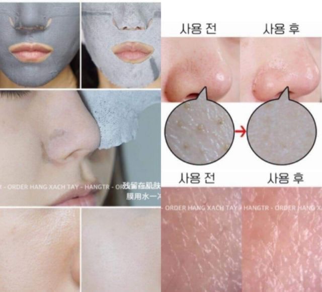 Hộp 5m MẶT NẠ ĐẤT SÉT ĐEN 7 IN 1 TOTAL SOLUTION BLACK CLAY MASK | BigBuy360 - bigbuy360.vn