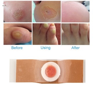 Bộ 12 Dụng Cụ Loại Bỏ Da Sử Dụng Được Nhiều Lần