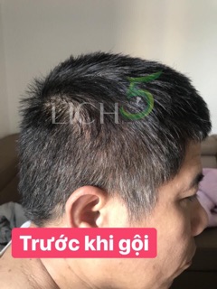 Dầu gội nhuộm tóc lich 5( cam kết hoàn tiền nếu không đen tóc)