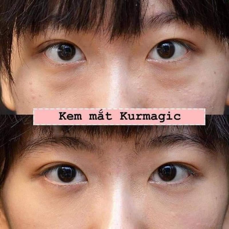 Kem mắt Kumargic Eye Cream Nhật Bản Túyp 20g - Xoá Tan Bọng Mắt, Vết Nhăn, Vết Chân Chim, xoá bỏ quầng thâm hiệu quả | BigBuy360 - bigbuy360.vn