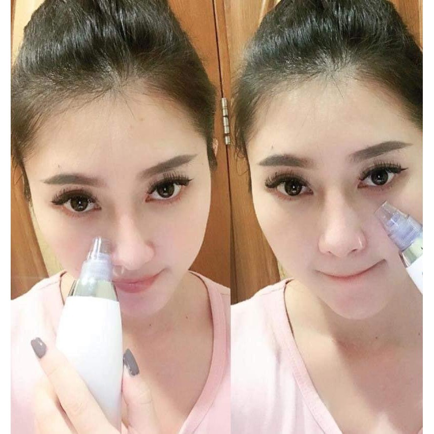 Máy hút mụn cầm tay Black Head Detector | BigBuy360 - bigbuy360.vn