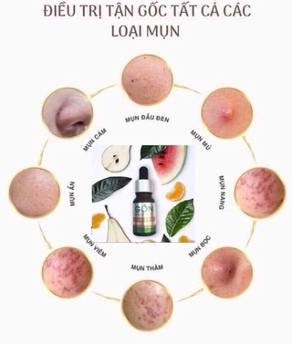 SERUM GON DƯỠNG TRẮNG HỒNG DA