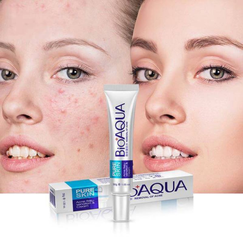 Tuýp kem bôi mụn PURE SKIN CỦA Bioaqua | BigBuy360 - bigbuy360.vn