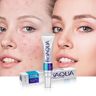 Tuýp kem bôi mụn pure skin của bioaqua