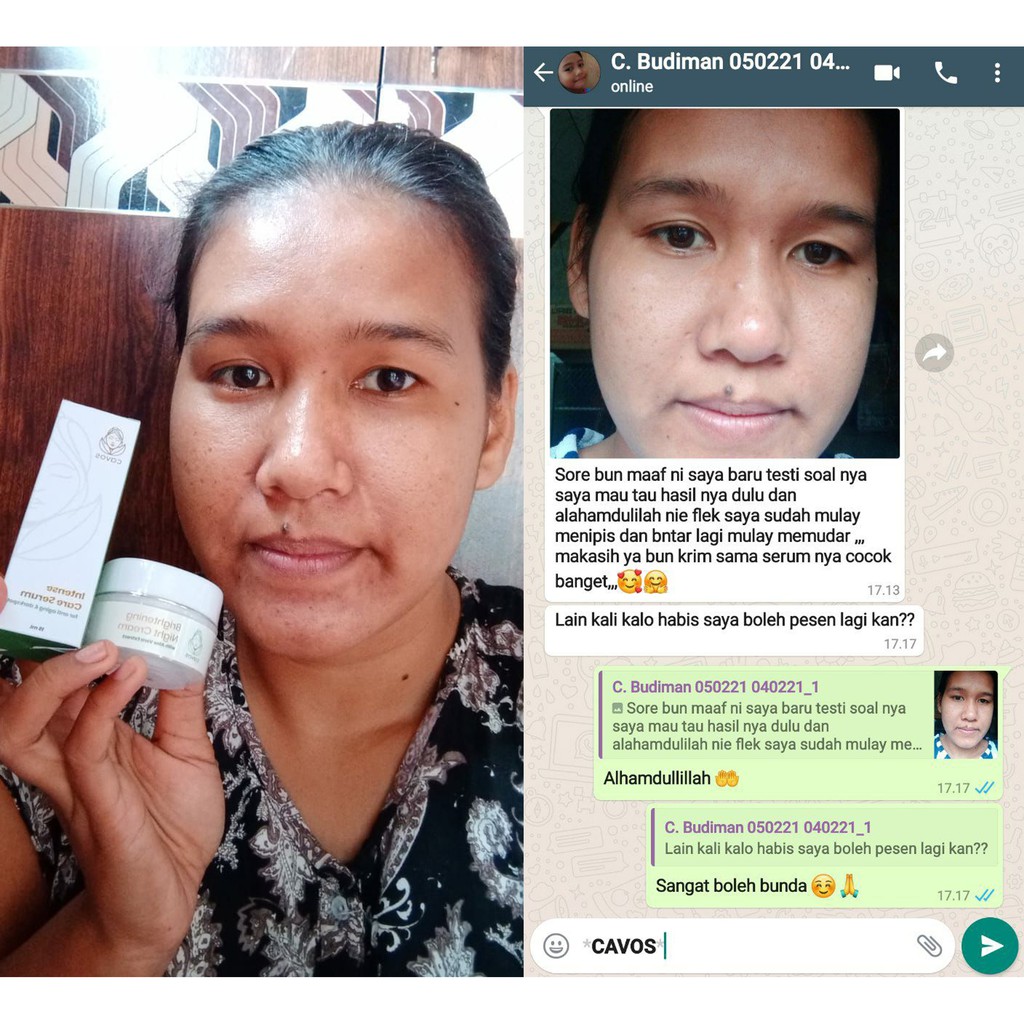 (Hàng Mới Về) Serum Cavos Chăm Sóc Da Ban Ngày + Kem Trị Mụn Trứng Cá / Nám / Chống Tia Uv / / Nám / / / / / Nám / Mụn Trứng Cá / / /