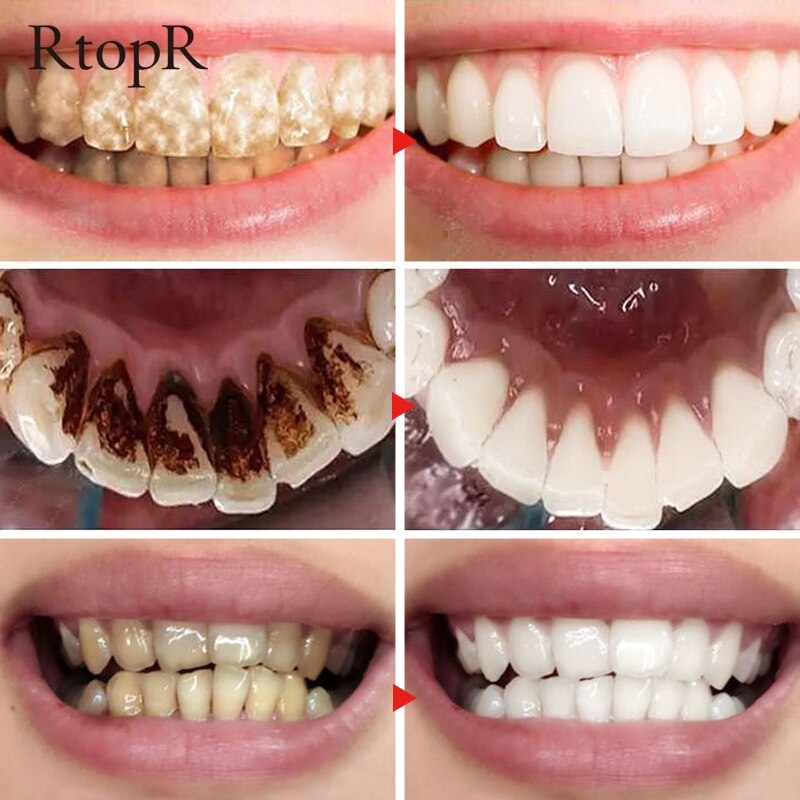 Bột trắng răng RtopR tinh chất ngọc trai tự nhiên vệ sinh răng miệng loại bỏ vết bẩn mảng bám 55g